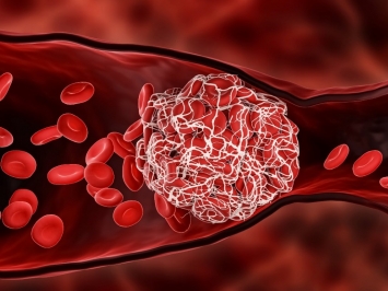 Khoa học chứng minh huyết giác có tác dụng tan cục máu đông