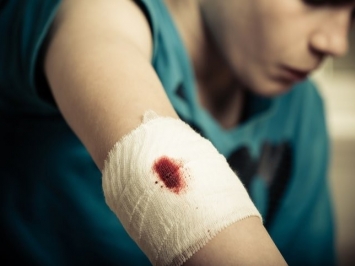 Cách cầm máu nhanh khi bị thương nên tìm hiểu ngay phòng khi cần