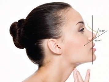 Mẹo làm giảm sưng do nâng mũi cực đơn giản